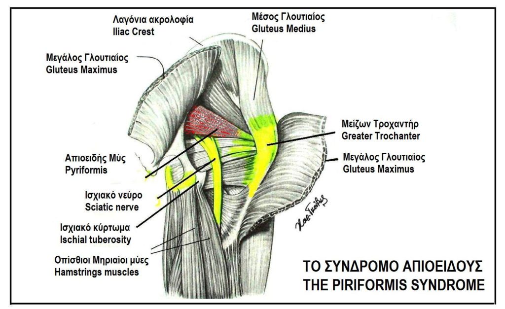 Piriformis Syndrome Morley Chiropractor